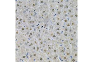 Immunohistochemistry of paraffin-embedded rat liver using SPHK1 Antibody (ABIN5970017) at dilution of 1/200 (40x lens). (SPHK1 anticorps)