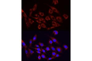 Immunofluorescence analysis of NIH/3T3 cells using PI3 Kinase p85 alpha antibody (ABIN6130617, ABIN6145642, ABIN6145645 and ABIN6215197) at dilution of 1:100. (PIK3R1 anticorps  (AA 240-380))