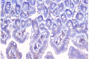 IHC analysis of Aromatase using anti-Aromatase antibody (ABIN6719449).