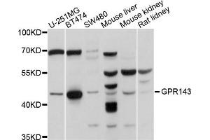 Western blot analysis of extracts of various cells, using GPR143 antibody. (GPR143 anticorps)