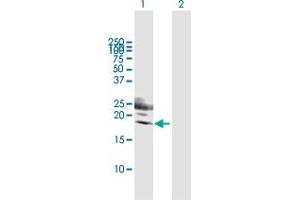 Western Blot analysis of KLRG1 expression in transfected 293T cell line by KLRG1 MaxPab polyclonal antibody.