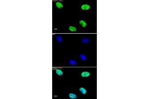Histone H4ac (pan-acetyl) antibody (pAb) tested by immunofluorescence.