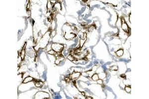 IHC analysis of CD31/PECAM1 using anti-CD31/PECAM1 antibody (ABIN7601076). (CD31 anticorps  (AA 28-382))