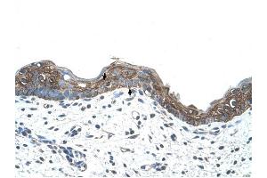 Ankyrin 1 antibody was used for immunohistochemistry at a concentration of 4-8 ug/ml to stain Squamous epithelial cells (arrows) in Human Skin.