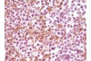 Immunohistochemistry (IHC) image for anti-Synuclein, alpha (SNCA) (truncated) antibody (ABIN2464103)