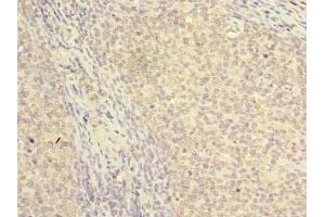 Immunohistochemistry of paraffin-embedded human tonsil tissue using ABIN7161534 at dilution of 1:100 (NKIRAS2 anticorps  (AA 1-191))