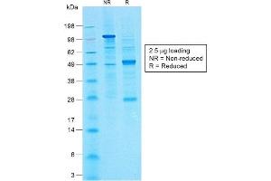 SDS-PAGE Analysis of Purified CA19-9 Rabbit Monoclonal Antibody (CA19. (CA 19-9 anticorps)
