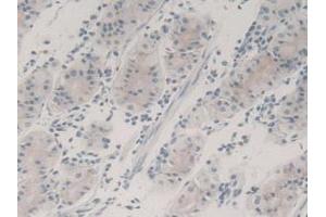 Detection of TGFb3 in Human Stomach Tissue using Monoclonal Antibody to Transforming Growth Factor Beta 3 (TGFb3)