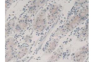Detection of TGFb3 in Human Stomach Tissue using Monoclonal Antibody to Transforming Growth Factor Beta 3 (TGFb3) (TGFB3 anticorps  (AA 24-300))