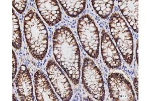 IHC analysis of Claudin 3/CLDN3 using anti-Claudin 3/CLDN3 antibody (ABIN7599625). (Claudin 3 anticorps  (AA 101-220))