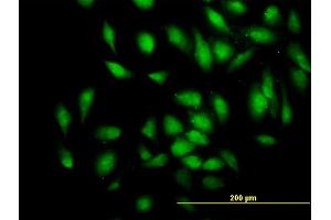 Immunofluorescence of monoclonal antibody to PDE4DIP on HeLa cell.