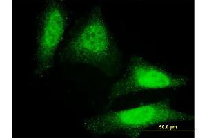 Immunofluorescence of monoclonal antibody to DAZ1 on HeLa cell.