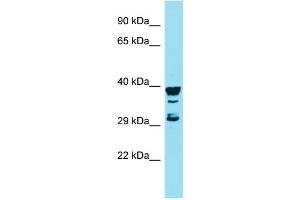 Host: Rabbit Target Name: RGS7BP Sample Type: MCF7 Whole Cell lysates Antibody Dilution: 1. (RGS7BP anticorps  (Middle Region))