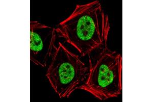 Fluorescent image of Hela cells stained with PCGF6 Antibody (C-term) (ABIN6243439 and ABIN6577713).