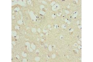 Immunohistochemistry of paraffin-embedded human brain tissue using ABIN7158523 at dilution of 1:100 (ACSL6 anticorps  (AA 458-697))