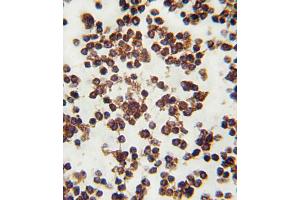 Formalin-fixed and paraffin-embedded human lymph tissue reacted with ALOX15 antibody (C-term), which was peroxidase-conjugated to the secondary antibody, followed by DAB staining. (ALOX15 anticorps  (C-Term))