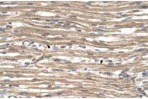 Immunohistochemical staining (Formalin-fixed paraffin-embedded sections) of human muscle with ACTR2 polyclonal antibody  at 4-8 ug/mL working concentration. (ACTR2 anticorps  (N-Term))