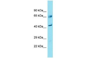 Western Blotting (WB) image for anti-Family with Sequence Similarity 83, Member A (FAM83A) (C-Term) antibody (ABIN2791509) (FAM83A anticorps  (C-Term))