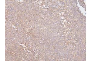 IHC analysis of SLC12A5 using anti-SLC12A5 antibody (ABIN6719415).