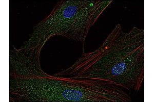 Immunocytochemistry analysis of Fyn in human primary fibroblasts using anti-Fyn (FYN-01, green).