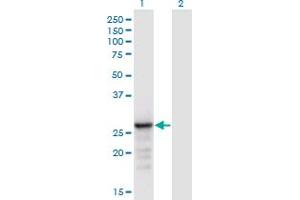 Western Blot analysis of ANP32B expression in transfected 293T cell line by ANP32B monoclonal antibody (M05), clone 8E10.