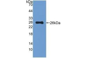 Detection of Recombinant MUC5B, Mouse using Polyclonal Antibody to Mucin 5 Subtype B (MUC5B)