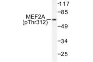 Image no. 1 for anti-Myocyte Enhancer Factor 2A (MEF2A) (pThr312) antibody (ABIN318067)