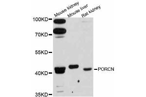 Western blot analysis of extracts of various cell lines, using PORCN antibody (ABIN6292717) at 1:3000 dilution.