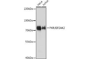 Western blot analysis of extracts of various cell lines, using PKR/PKR/EIF2 antibody (ABIN1679688 and ABIN3018462) at 1:1000 dilution. (EIF2AK2 anticorps)