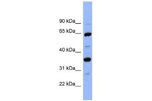 SERPINC1 antibody used at 1 ug/ml to detect target protein. (SERPINC1 anticorps)