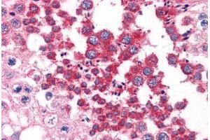 Human Testis: Formalin-Fixed, Paraffin-Embedded (FFPE)