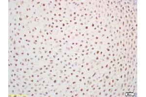 Formalin-fixed and paraffin embedded mouse embryo labeled with Rabbit Anti ZNF268 Polyclonal Antibody, Unconjugated  at 1:200 followed by conjugation to the secondary antibody and DAB staining (ZNF268 anticorps  (AA 286-358))