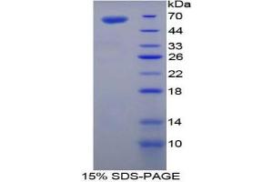 SDS-PAGE analysis of Mouse TGM1 Protein. (TGM1 Protéine)