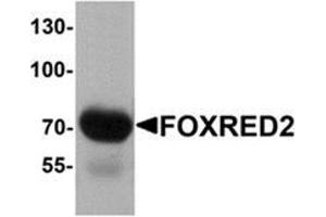 Western blot analysis of FOXRED2 in human lung tissue lysate with FOXRED2 antibody at 1 μg/mL. (FOXRED2 anticorps  (N-Term))