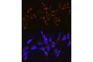 Immunohistochemistry of paraffin-embedded human esophageal cancer using ATPB Rabbit mAb (ABIN7265722) at dilution of 1:100 (40x lens).