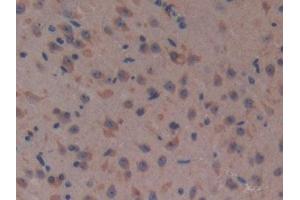 Detection of CFH in Mouse Brain Tissue using Polyclonal Antibody to Complement Factor H (CFH)