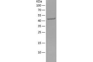 Fibronectin Protein (AA 1008-1231) (His-IF2DI Tag)