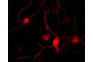 Immunocytochemistry (ICC) image for anti-RAB26, Member RAS Oncogene Family (RAB26) antibody (ABIN1742529)