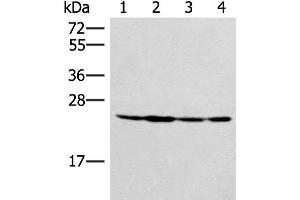 Western blot analysis of Hela 231 and A549 cell Mouse liver tissue lysates using SSSCA1 Polyclonal Antibody at dilution of 1:400 (SSSCA1 anticorps)