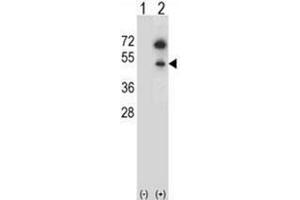 Western blot analysis of GNAS (arrow) using GNAS Antibody (C-term) Cat. (GNAS anticorps  (C-Term))
