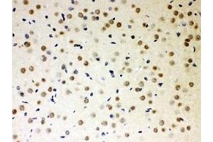 IHC-P: PKC iota antibody testing of rat brain tissue (PKC iota anticorps  (AA 21-214))