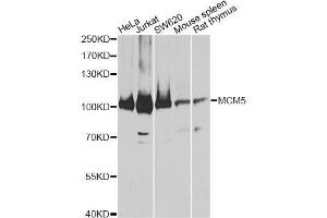 Western blot analysis of extracts of various cell lines, using MCM5 antibody. (MCM5 anticorps  (AA 1-230))