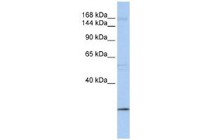 UBR2 antibody used at 1 ug/ml to detect target protein. (UBR2 anticorps  (C-Term))
