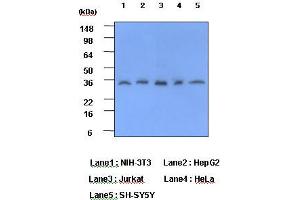 Western Blotting (WB) image for anti-C-Reactive Protein (CRP) (AA 19-224) antibody (ABIN317507) (CRP anticorps  (AA 19-224))