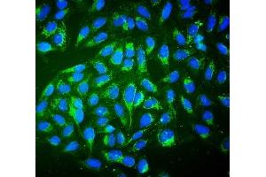 IF analysis of ALDH2 using anti-ALDH2 antibody (ABIN7603122). (ALDH2 anticorps  (N-Term))