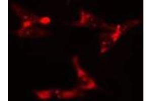 ABIN6275900 staining  HuvEc cells by IF/ICC. (TOLLIP anticorps  (Internal Region))