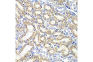 Immunohistochemistry of paraffin-embedded rat kidney using DAP antibody (ABIN6130322, ABIN6139397, ABIN6139398 and ABIN6221757) at dilution of 1:200 (40x lens). (DAP anticorps  (AA 1-102))