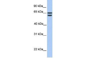WB Suggested Anti-CDYL2 Antibody Titration:  0. (CDYL2 anticorps  (N-Term))