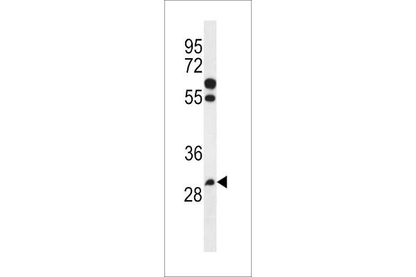 PGAP3 antibody  (AA 141-169)