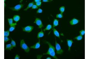 IF analysis of LARP1 using anti-LARP1 antibody (ABIN7599861). (LARP1 anticorps  (AA 123-401))